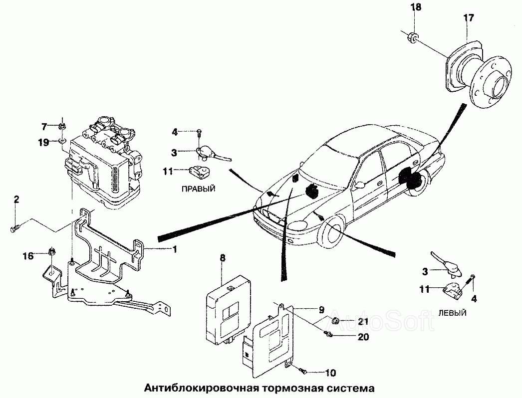 Антиблокировочная тормозная система